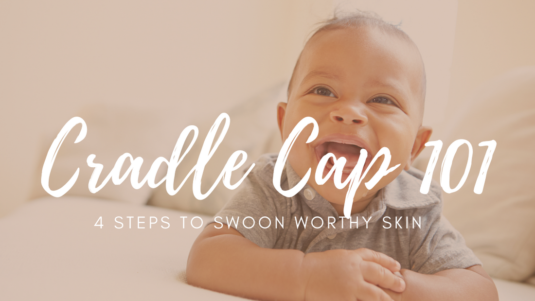 Cradle Cap 101 - 4 Steps to Swoon Worthy Skin
