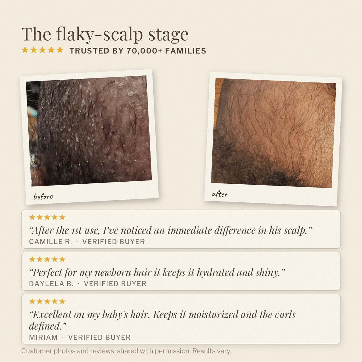 Customer photos of a baby scalp before and after the Nourishing Baby routine, with reviews