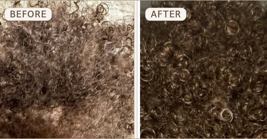 Loosen flakes, soothe the scalp